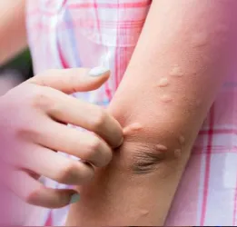 Japanese Encephalitis Treatment