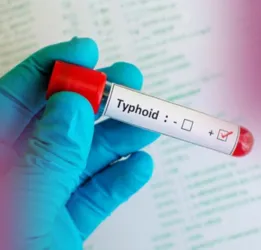 Typhoid Fever Treatment