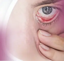 Xerophthalmia Treatment