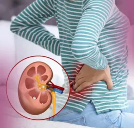 Kidney Stones Treatment