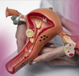 Ovarian Cysts Treatment