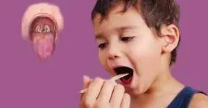 Diphtheria Treatment