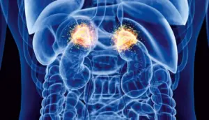 Addison’s Disease Treatment