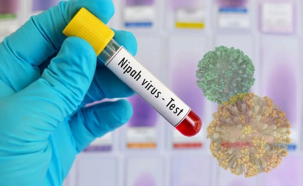 Nipah Virus Treatment