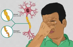 Multiple Sclerosis Treatment